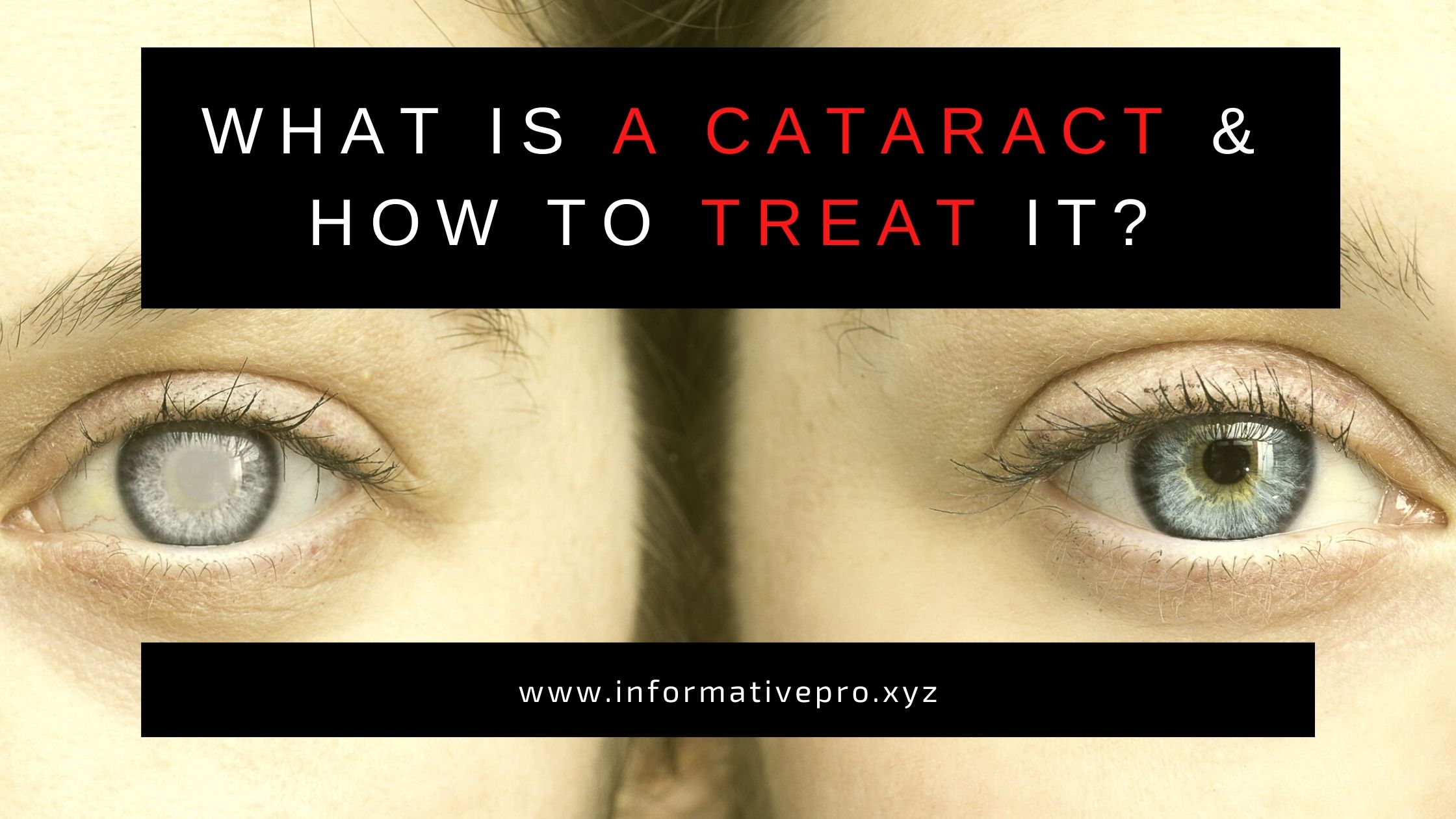 how to treat cataract